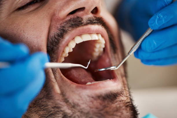 Best Urgent Care for Lost Fillings or Crowns in Prairie Ridge, WA