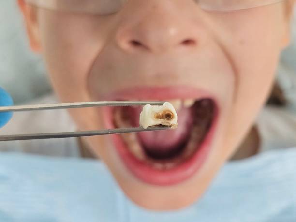 Best Emergency Gum Treatment in Prairie Ridge, WA